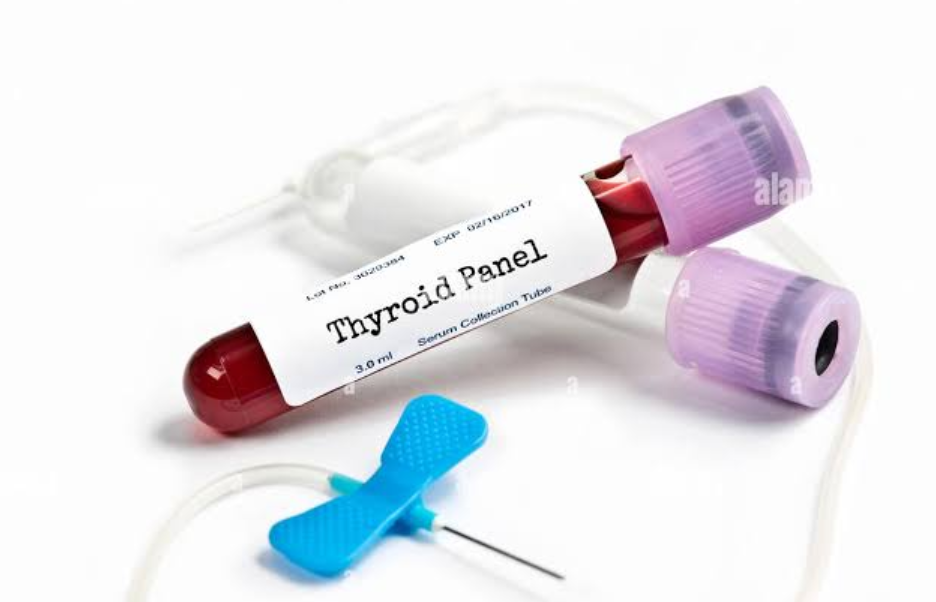 Thyroid Profile Sample Collection Indore